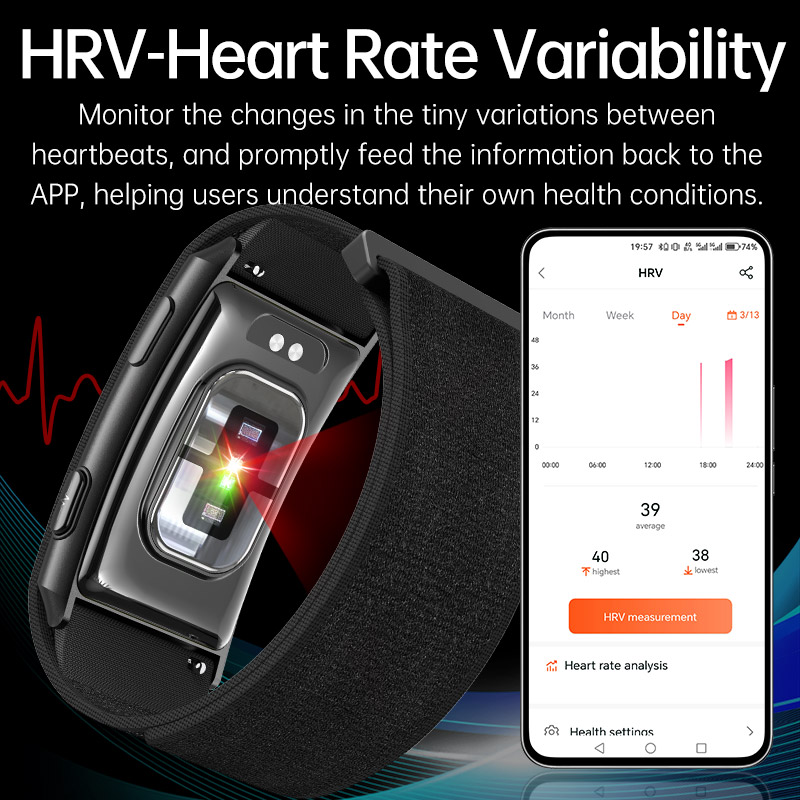 VWAR LOOP X ECG สร้อยข้อมืออัจ - Xbody Health & Wellness Wayne Nj บทวิจารณ์และราคา